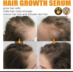 Biotin Hair Growth Serum by EELHOE - Anti-Hair Loss Treatment
