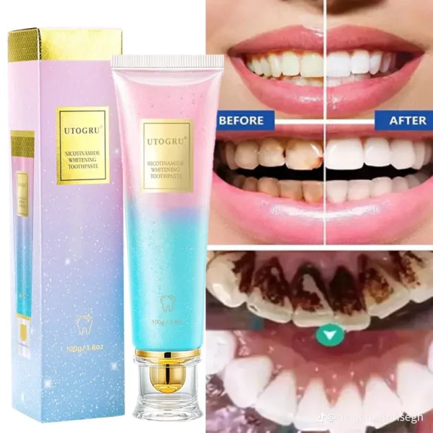 UTOGRU Nicotinamide Whitening Toothpaste Get Whiter Teeth in Just 7 Days — Without Expensive Dental Treatments