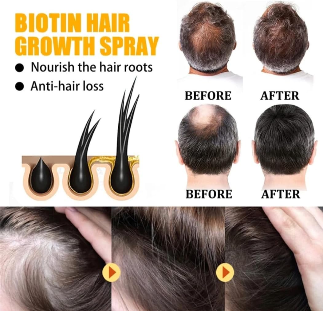 Biotin Hair Growth Serum by EELHOE - Anti-Hair Loss Treatment