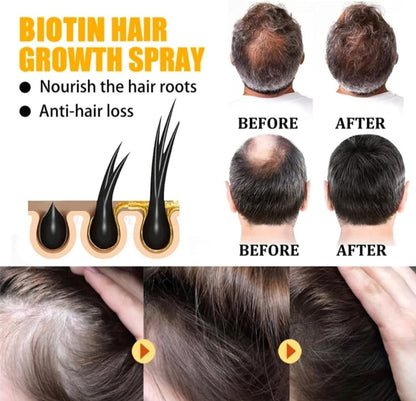 Biotin Hair Growth Serum by EELHOE - Anti-Hair Loss Treatment
