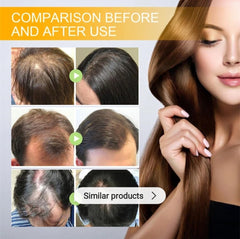 Biotin Hair Growth Serum by EELHOE - Anti-Hair Loss Treatment