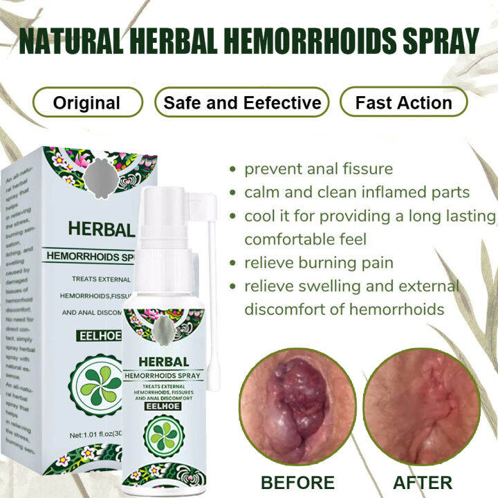 Hemorrhoid Relief Spray – Treatment for Swelling, Itching & Discomfort Support