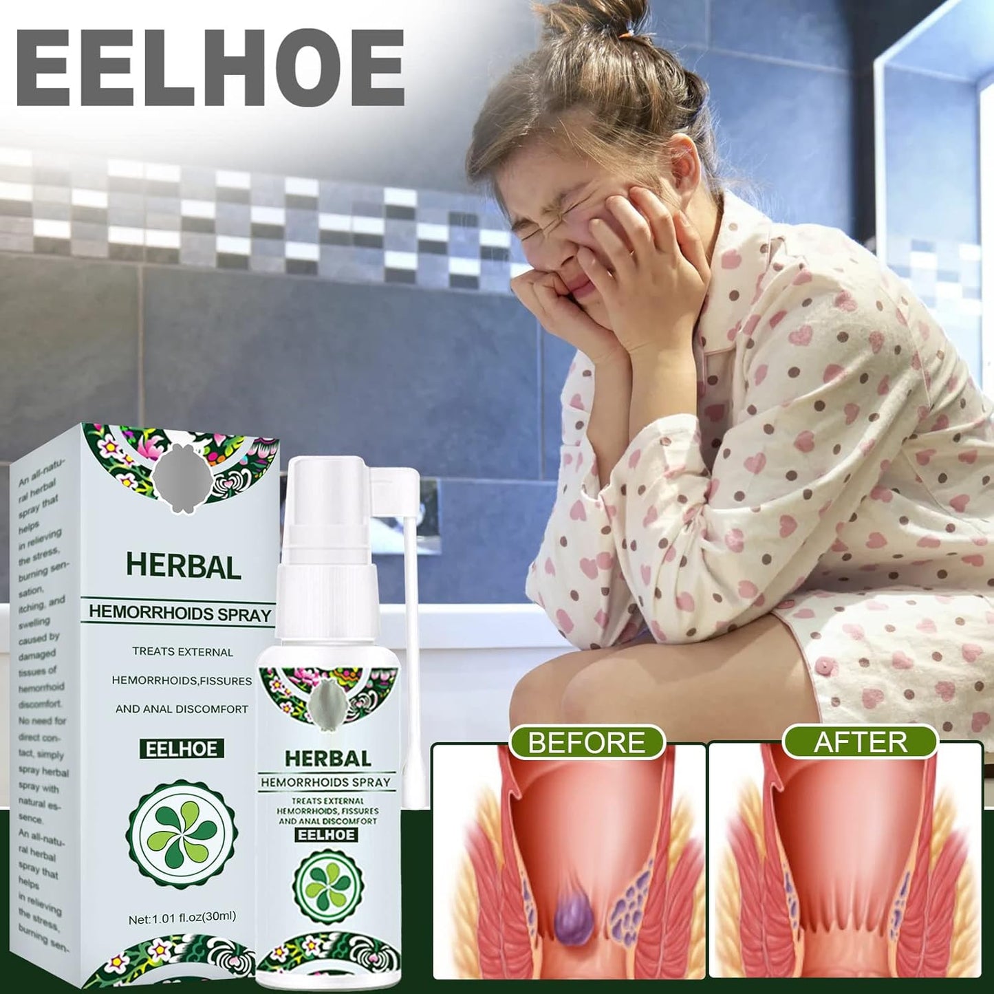 Hemorrhoid Relief Spray – Treatment for Swelling, Itching & Discomfort Support