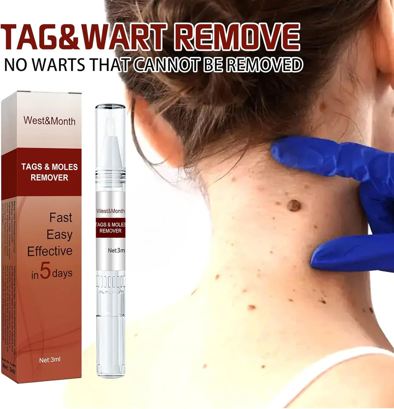 Jaysuing Liquid Wart Remover – Advanced Wart Removal Treatment