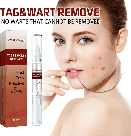 Jaysuing Liquid Wart Remover – Advanced Wart Removal Treatment
