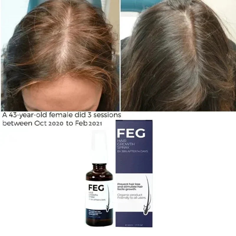 FEG Hair Growth Spray | Natural Anti-Hair Loss & Follicle Stimulating Treatment