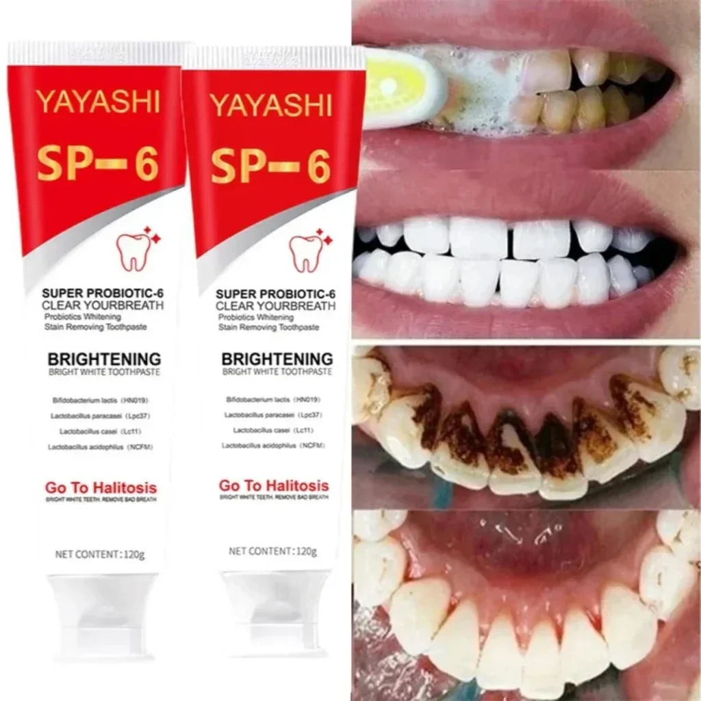 YAYASHI SP-6 Ultra Whitening Toothpaste – Probiotic Formula for Stain Removal
