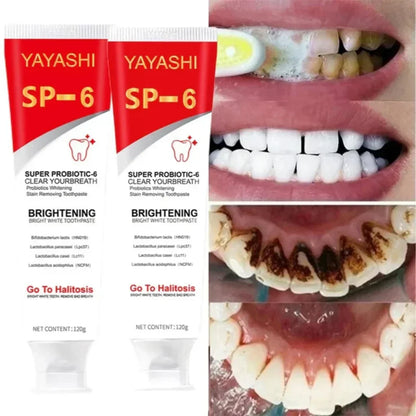YAYASHI SP-6 Ultra Whitening Toothpaste – Probiotic Formula for Stain Removal