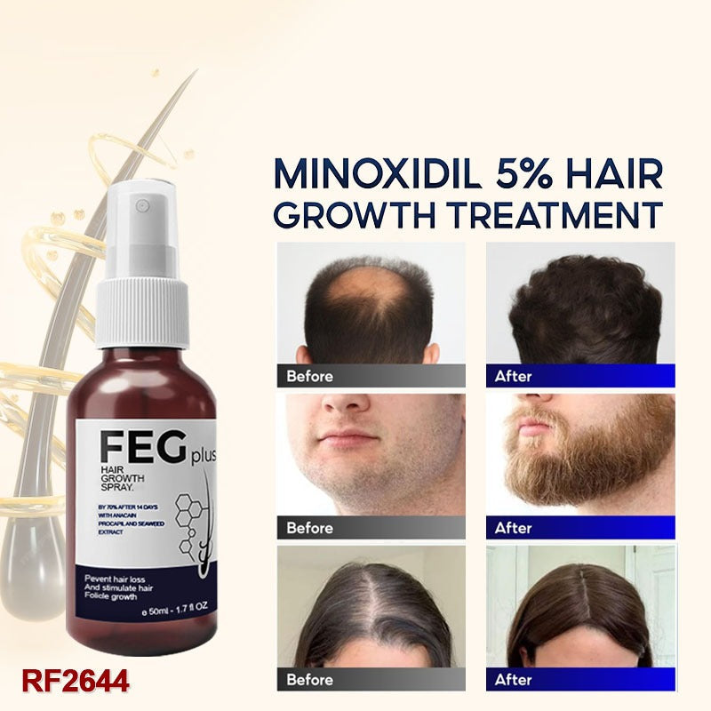 FEG Hair Growth Spray | Natural Anti-Hair Loss & Follicle Stimulating Treatment