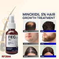 FEG Hair Growth Spray | Natural Anti-Hair Loss & Follicle Stimulating Treatment